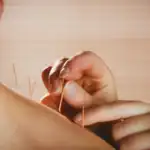Brazil Includes Acupuncture in Emergency Care Provided by State Hospitals